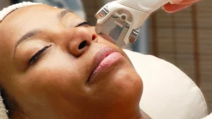 Why Is Laser Hair Removal Now Safe For Dark Skin